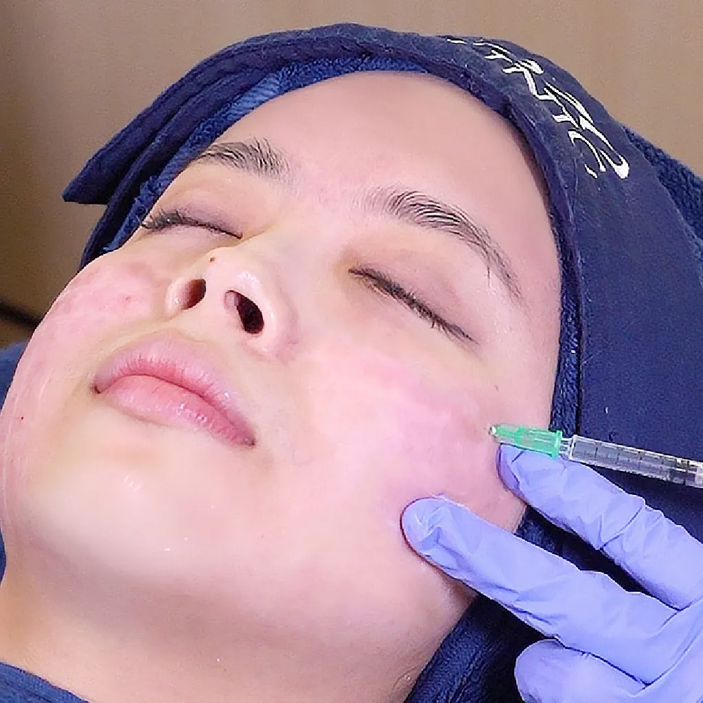 Xela Rederm