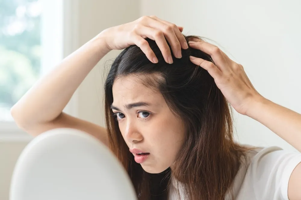 Perawatan Traction Alopecia Terbaik di Jakarta: Rambut Kembali Lebat