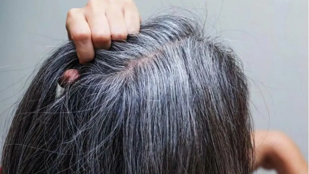 Cara Menghilangkan Uban Tanpa Merusak Rambut: Tips & Solusi Aman