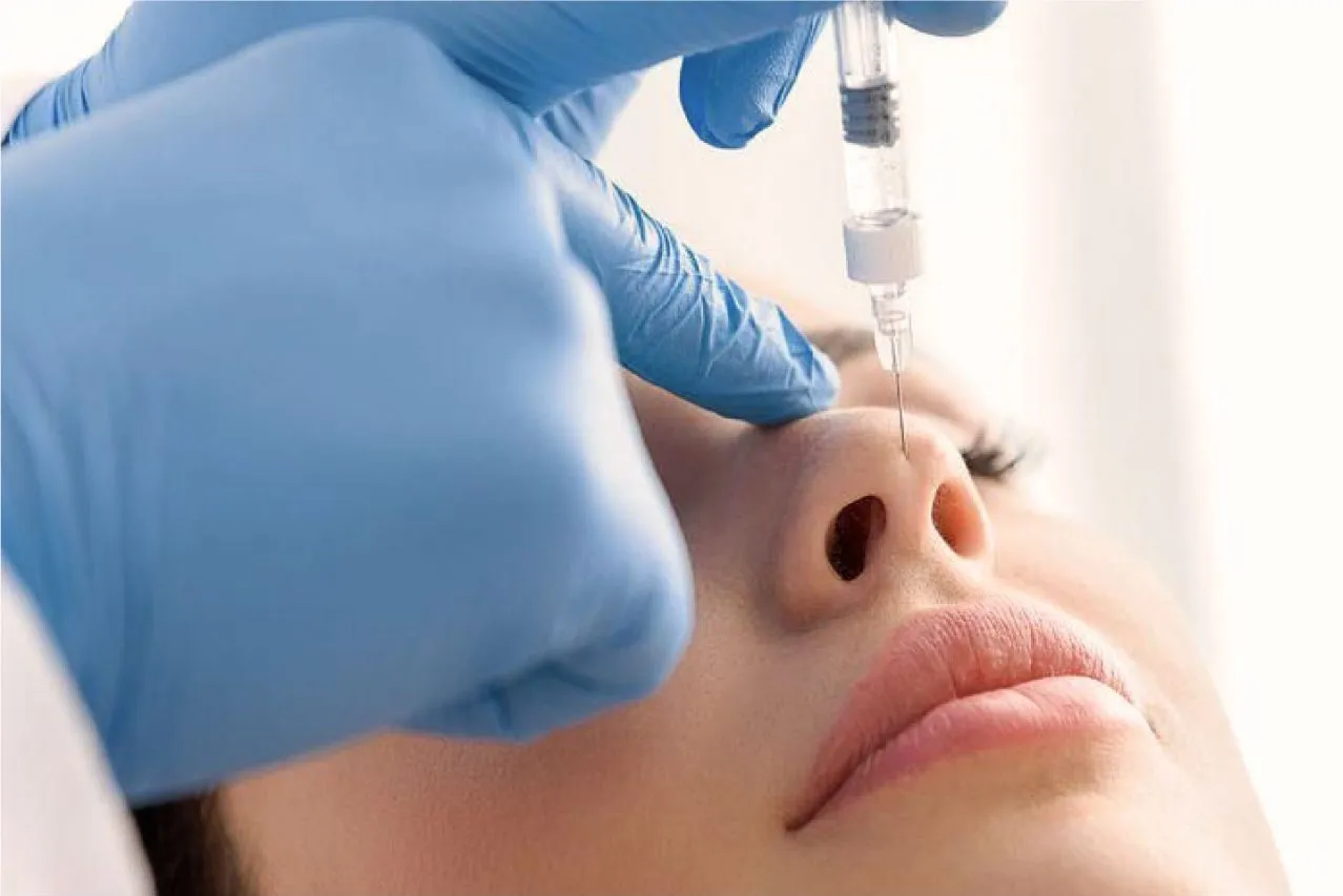 Filler Hidung vs Tanam Benang: Pilih Sesuai Bentuk