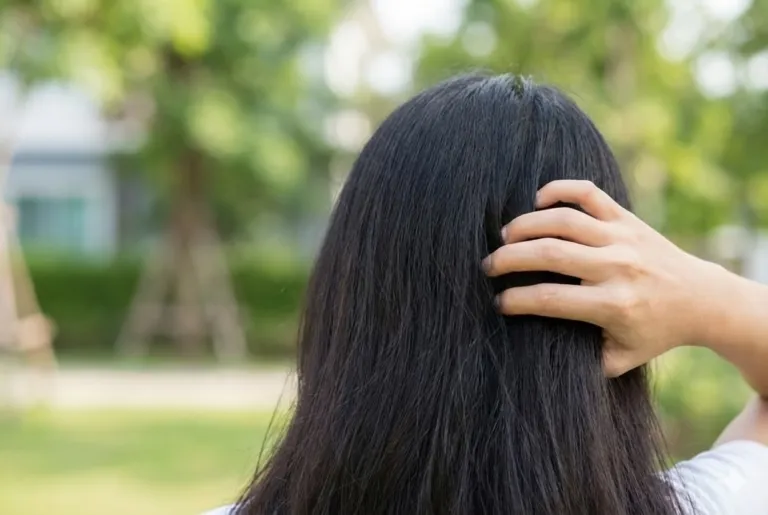 7 Cara Menghilangkan Telur Kutu Agar Rambut Bersih Tuntas