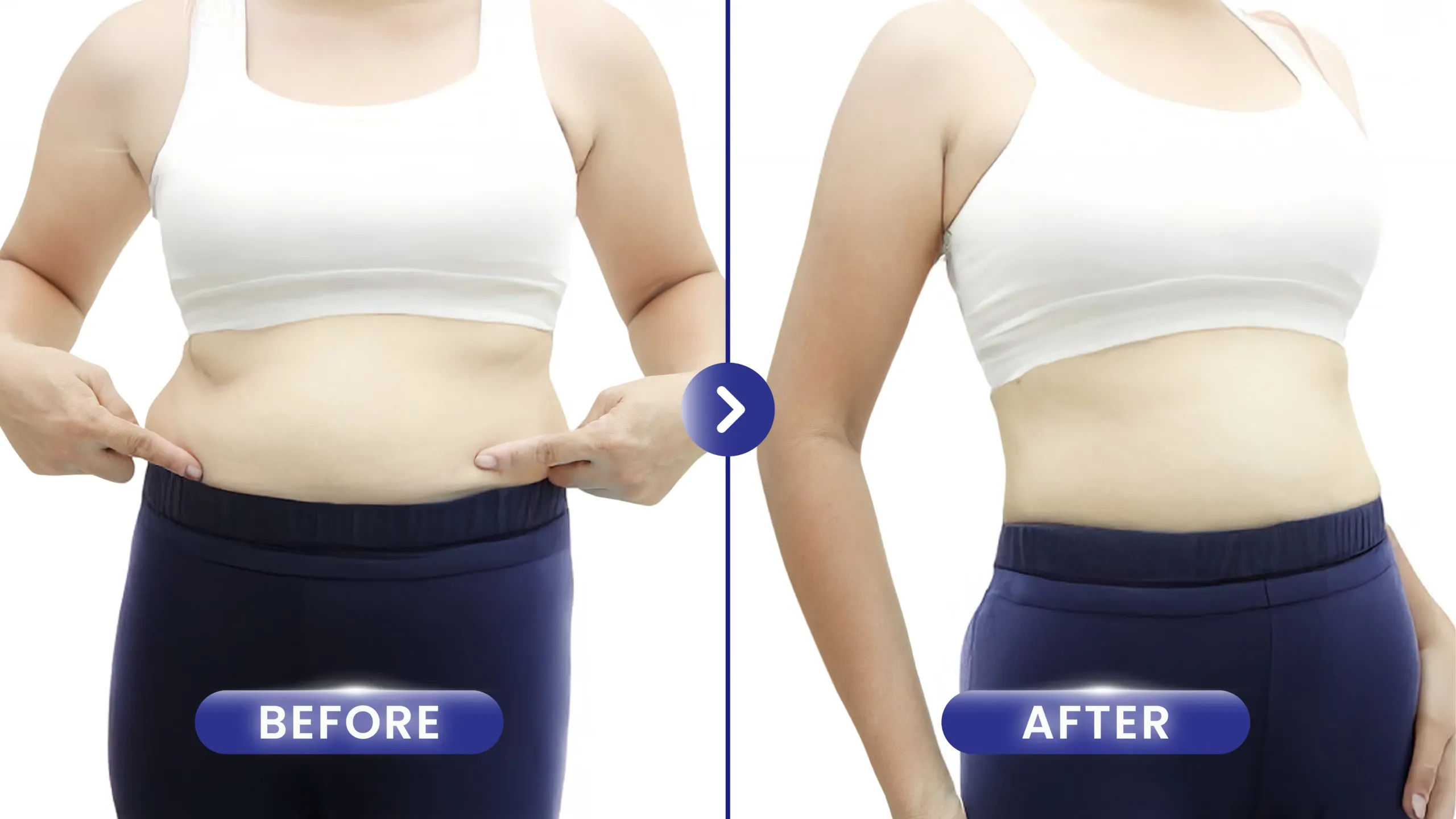 Before After Slimming Treatment