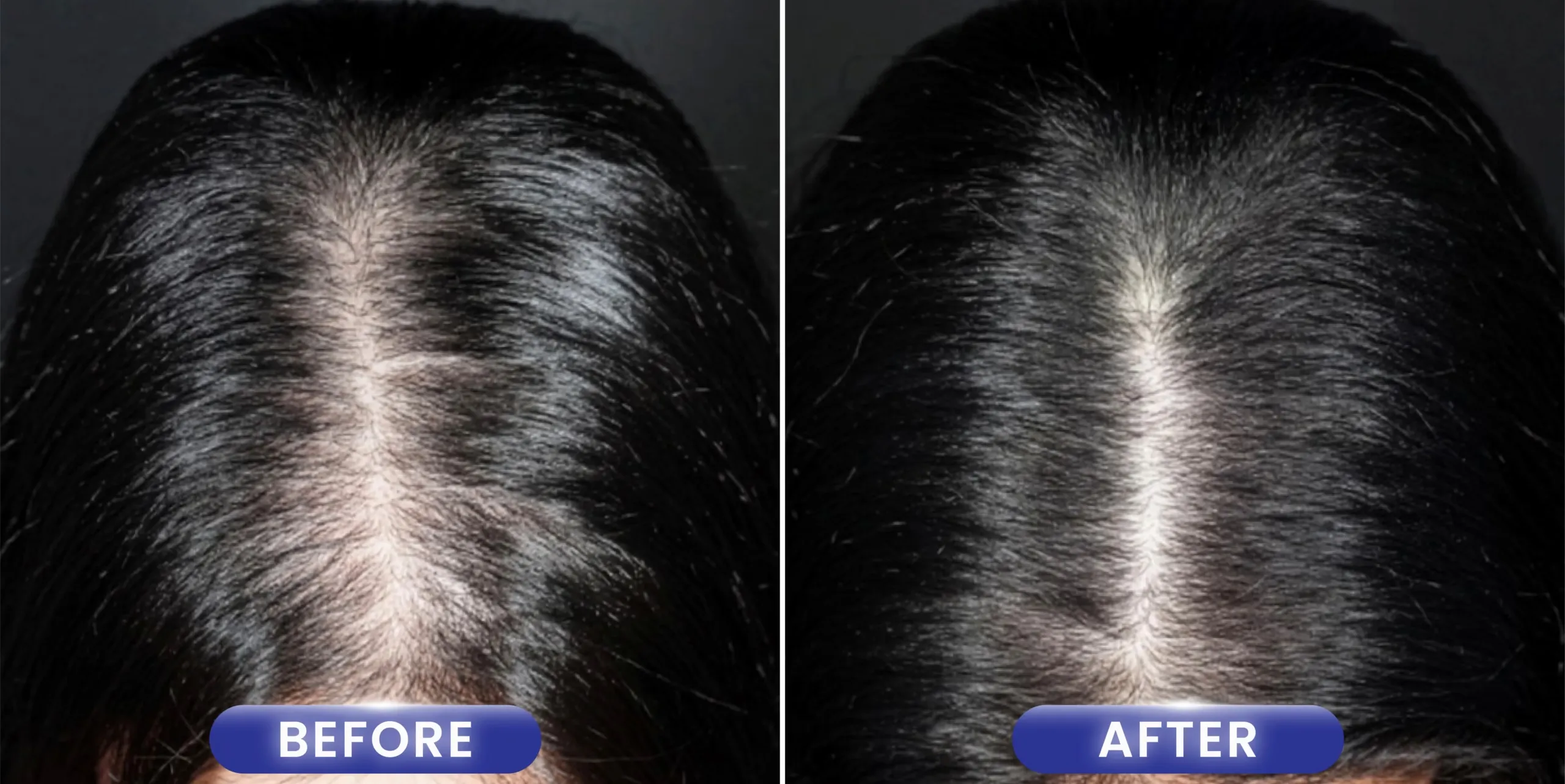 Landing Page - Before - After..