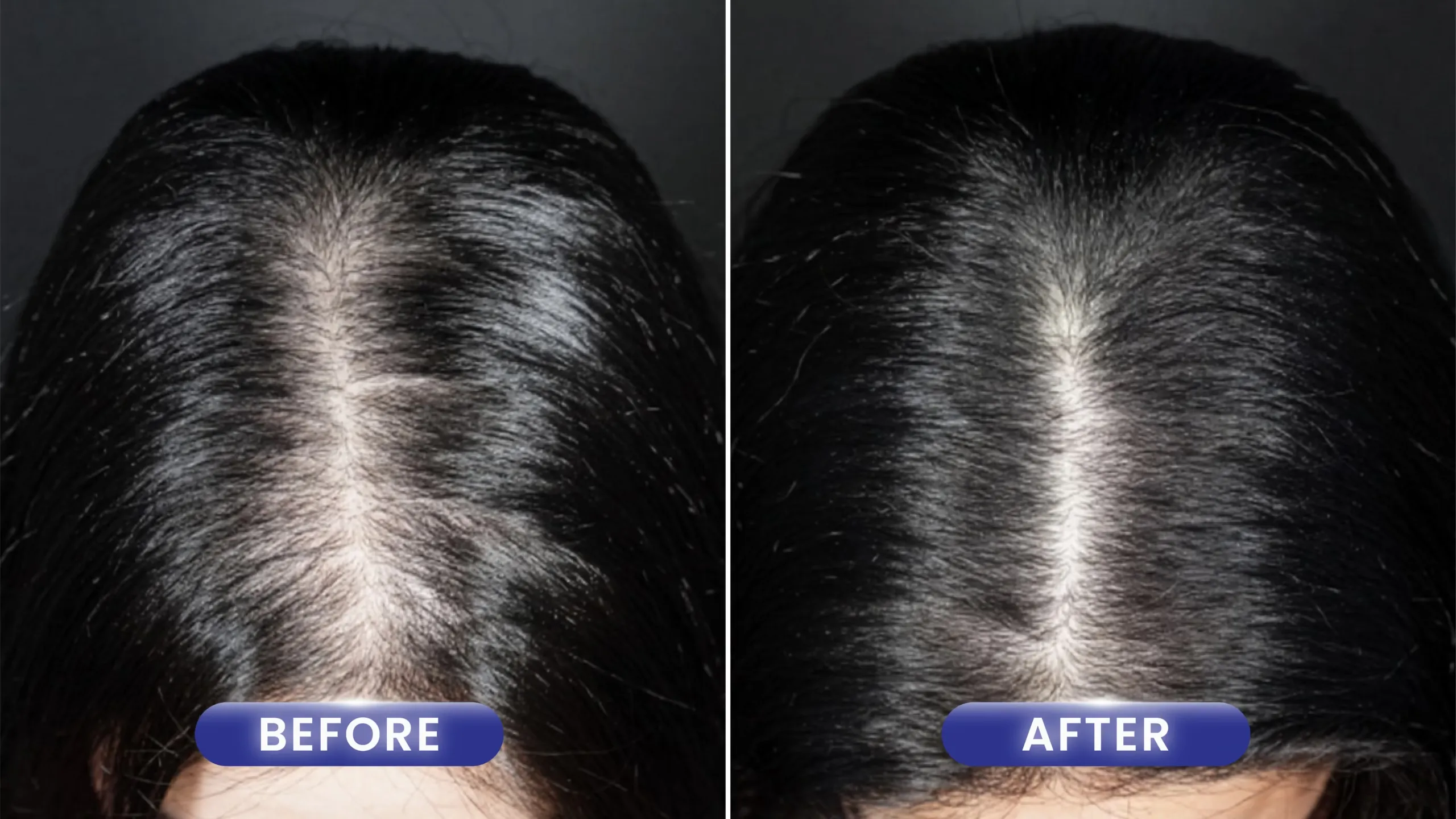 Before After Hair Treatment
