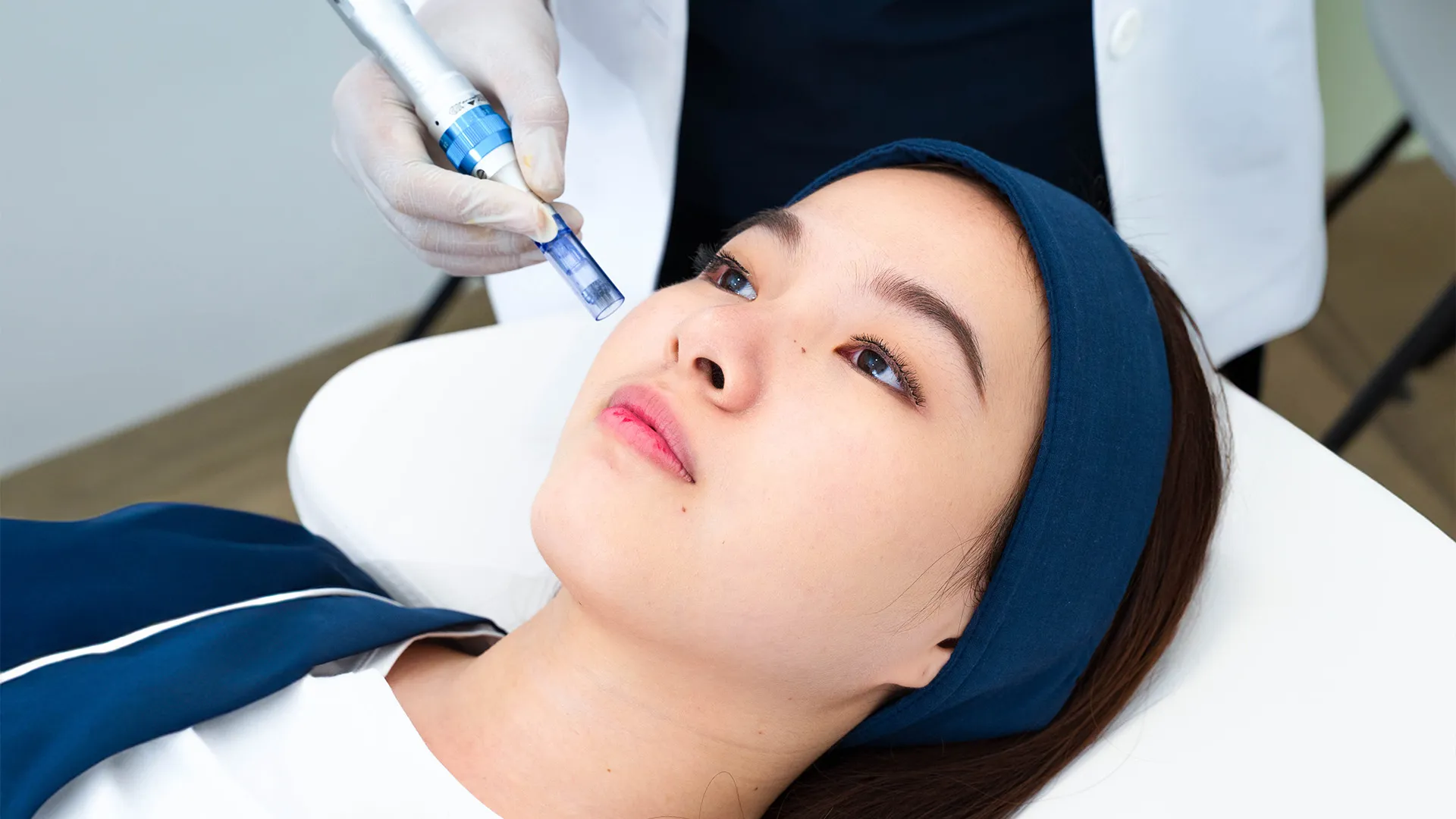 PRP Face Treatment Sozo Skin Clinic