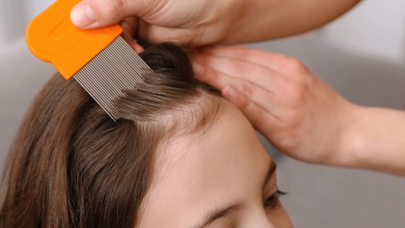 Cara Menghilangkan Kutu di Rambut yang Tuntas: Stop Salah Tahapan!