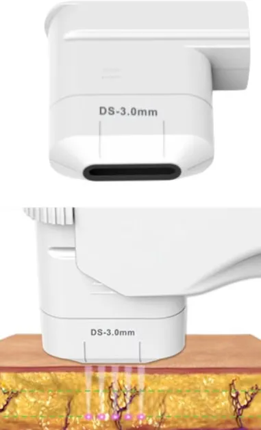 Alat HIFU cartridge 3.0mm