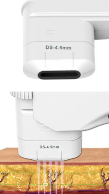 Alat HIFU cartridge 4.5mm