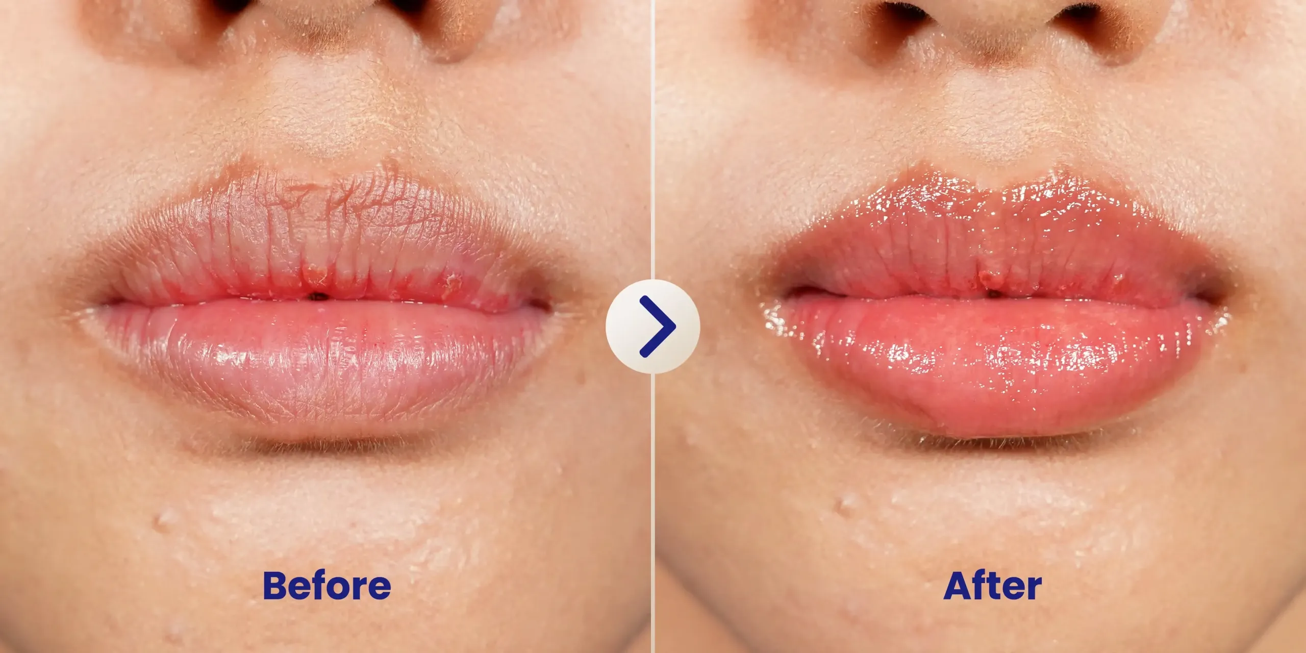 Before After 3