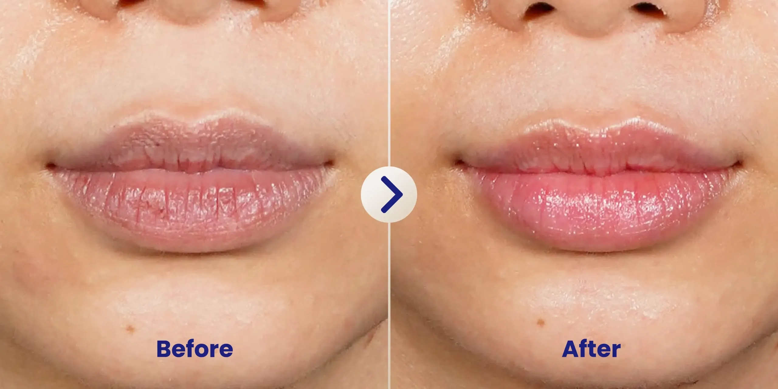 Before After 2