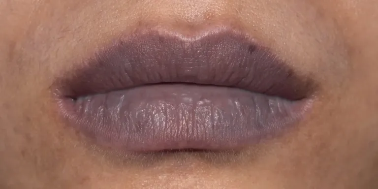 Bibir Hitam: Penyebab, Gejala & Cara Mengatasinya