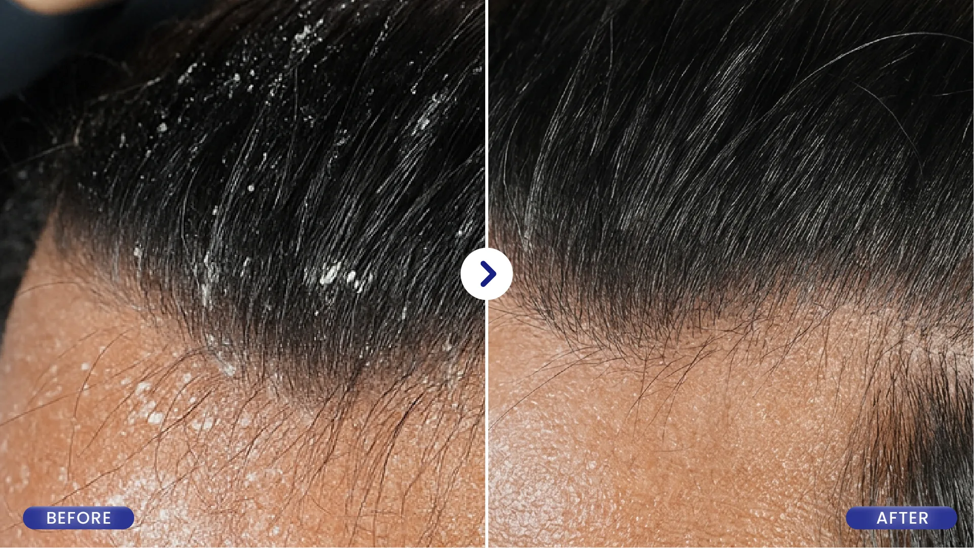 Hasil Perawatan Sebelum dan Sesudah SOZO Hair 2
