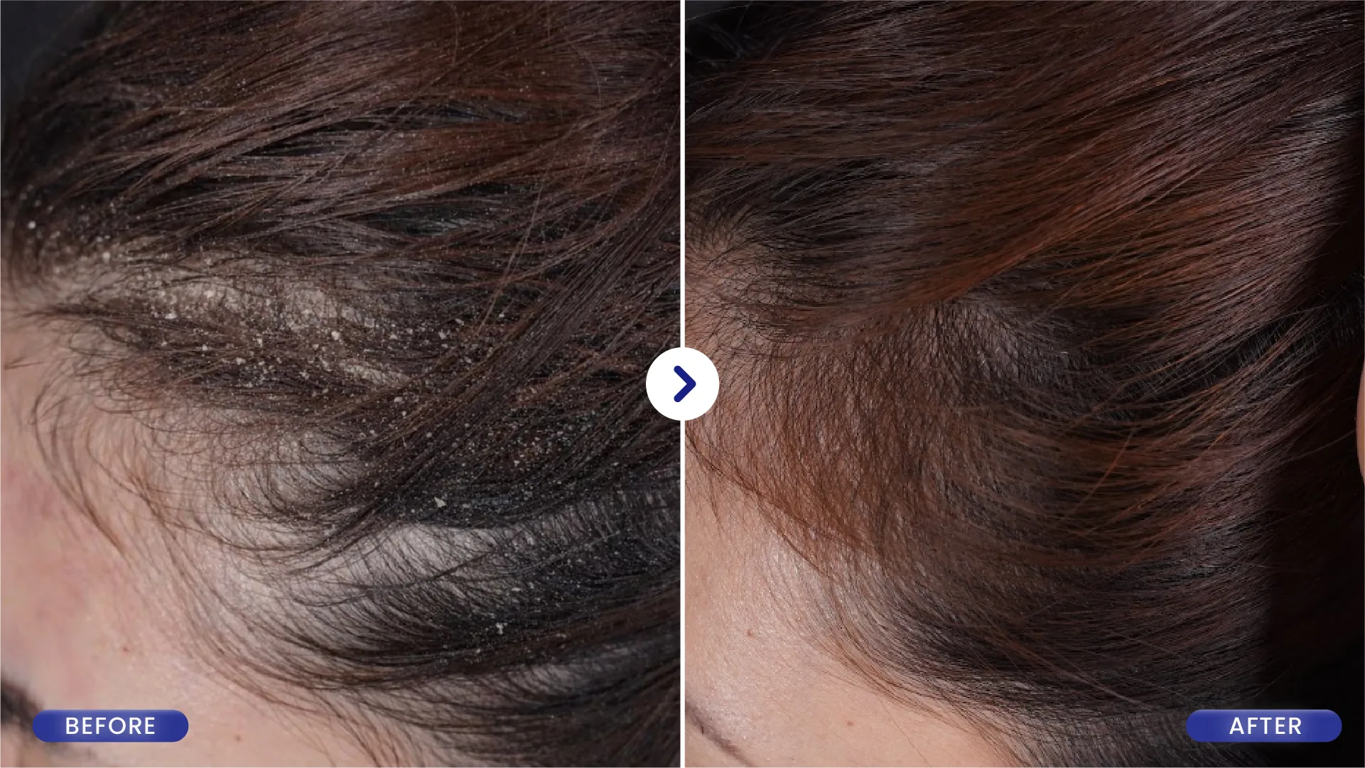 Hasil Perawatan Sebelum dan Sesudah SOZO Hair 1