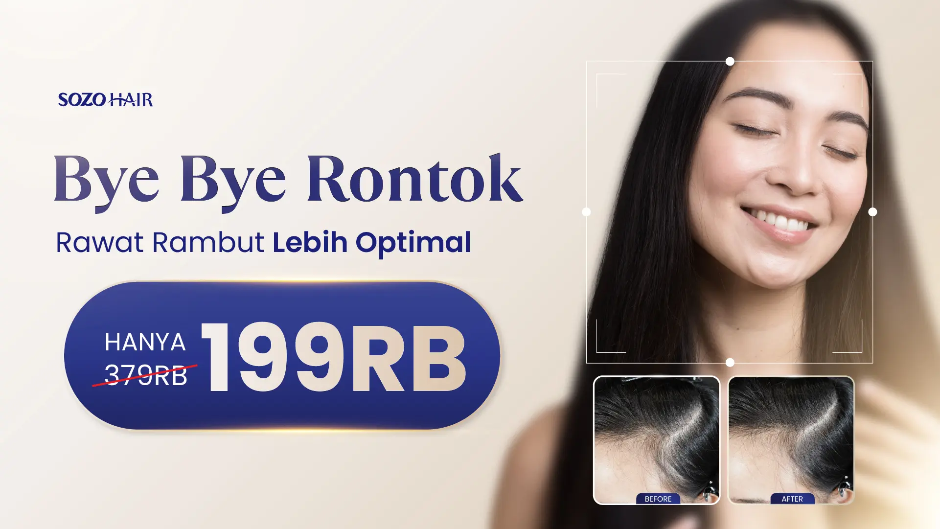 Promo Bye-Bye Rambut Rontok & Botak