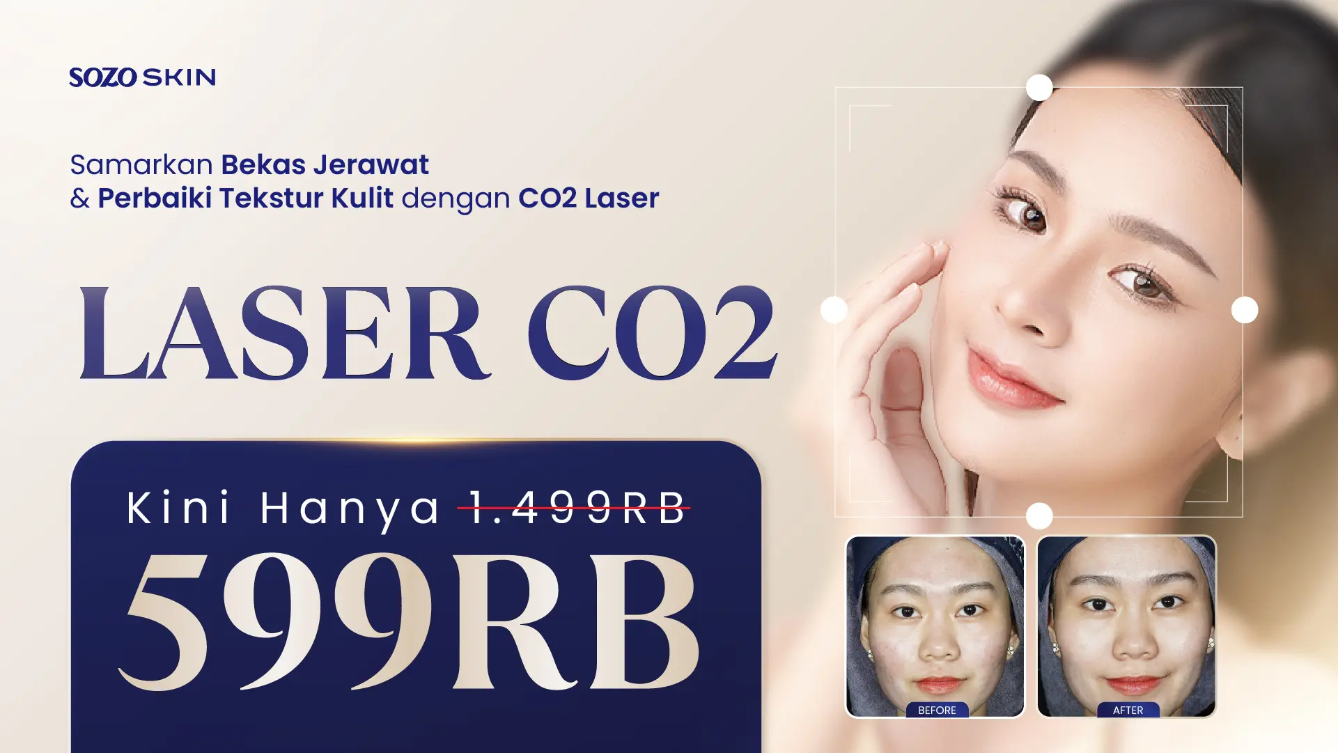 [LP Mockup] Landing Page Refreshment MEI - Promo banner laser co2