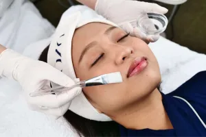 Prosedur Dermal Peel Sozo Skin Clinic