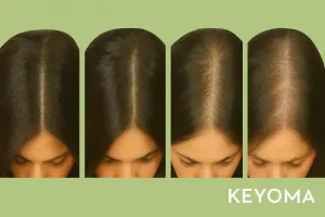 Gambar Belahan Rambut Melebar