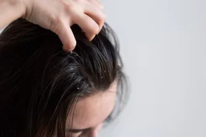Ilustrasi Rambut Lepek