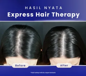 Hasil Express Hair Therapy Treatment Sozo Skin Clinic