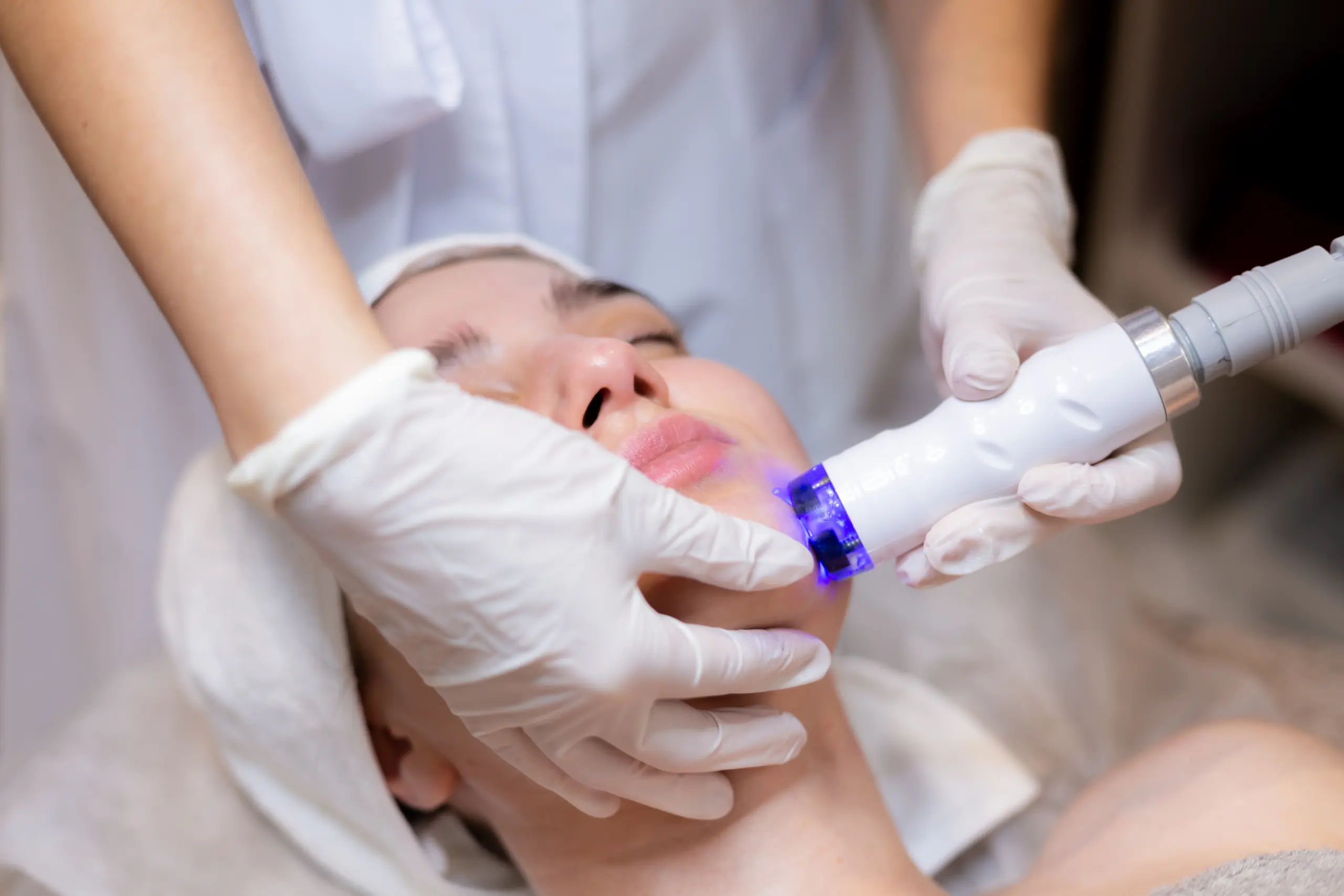 pantangan setelah pico laser