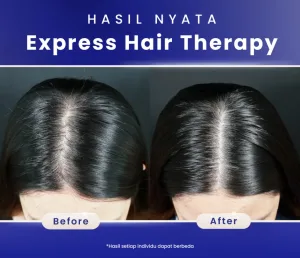 Hasil Treatment Express Hair Therapy