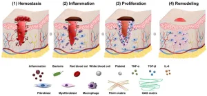 Fase Collagen Remodeling