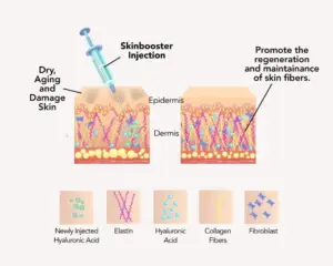 Ilustrasi Cara Kerja Skin Booster Rejuran HB