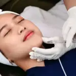 Apa itu Filler Treatment? Jenis, Efek Samping & Bedanya dengan Botox