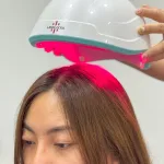 Low-Level Laser Therapy untuk Rambut: Ini Cara Kerja & Efektivitasnya