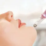 Apa Itu Exosome Treatment? Prosedur untuk Wajah Glowing Alami