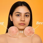 Purging pada Wajah: Penyebab, Tanda & Bedanya dengan Breakout