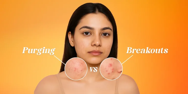 Purging pada Wajah: Penyebab, Tanda & Bedanya dengan Breakout