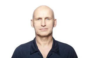 Alopecia Universalis