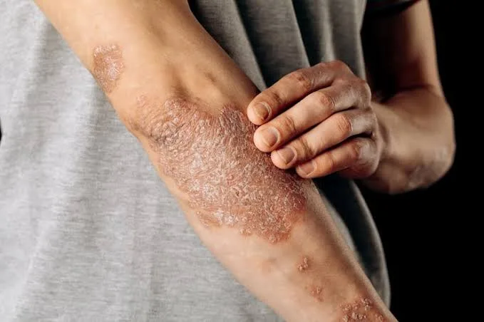 Epidermis: Fungsi, Jenis Lapisan & Cara Menjaga Kesehatannya
