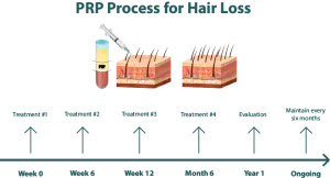 Siklus Pertumbuhan Rambut Setelah PRP Treatment