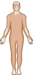 Vitiligo Nonsegmental