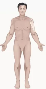 Vitiligo Segmental