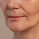 15 Cara Mengencangkan Kulit Wajah Usia 40, dari Alami hingga Treatment Klinik