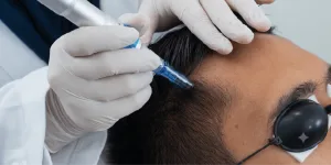 Prosedur Hair Grow Booster
