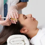 Meso Rambut: Manfaat, Prosedur, dan Bedanya dengan PRP & Microneedling