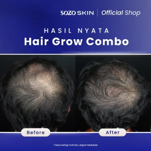Hasil Hair Grow Booster