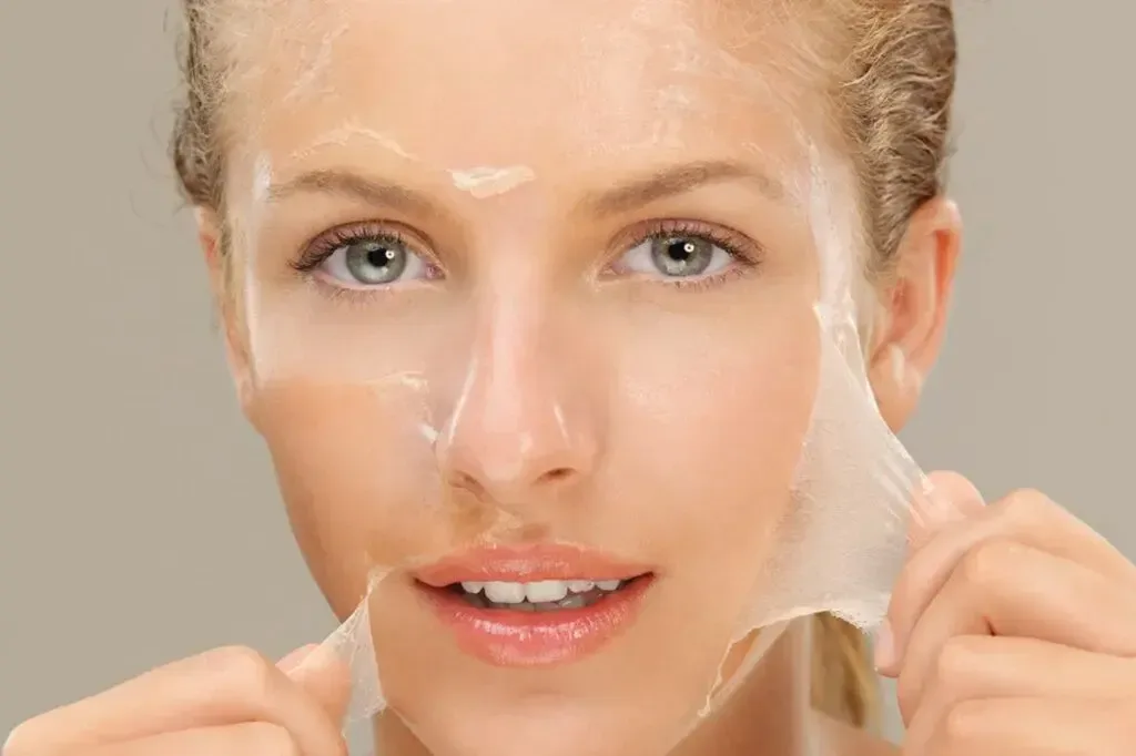 Acne Peel Eksfoliasi Kulit Berjerawat, Ketahui Manfaat dan Downtime-nya