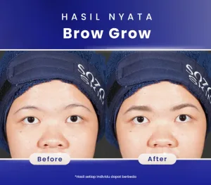 Hasil Brow Grow Treatment
