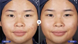 Hasil Nyata IPL Glow