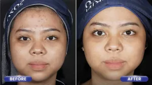 Hasil Facial Wajah