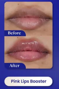 Hasil Pink Lips Booster