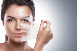 Ilustrasi Skin Peeling
