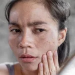 7 Kebiasaan Penyebab Kulit Kusam yang Sering Diabaikan