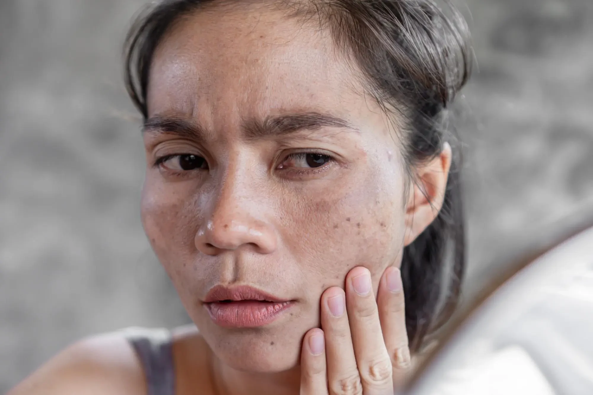 7 Kebiasaan Penyebab Kulit Kusam yang Sering Diabaikan