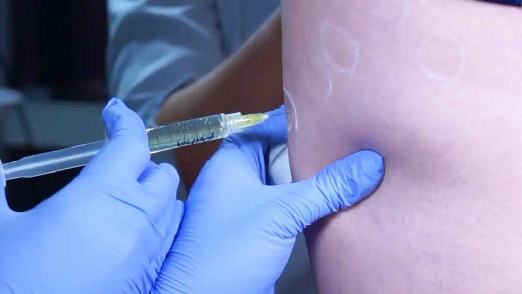 meso cellulift